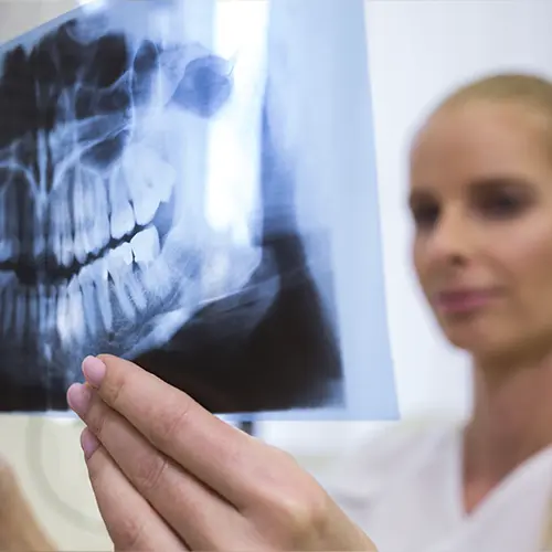 foto Radiologia Odontológica